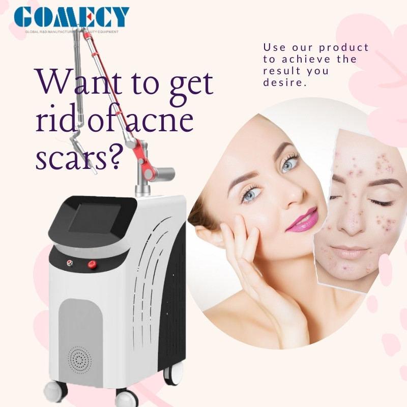 Revolutionary Picosecond Laser for Tattoo Removal 1064nm 755nm 532nm Gomecy Q Switched Nd Yag Laser