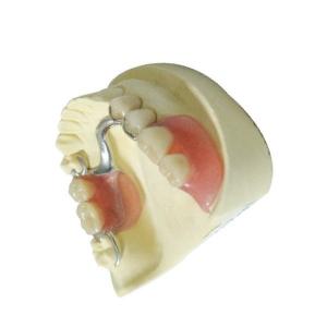 China Custom Made Dental Lab Products Polymer Removable Partial Dentures on sale