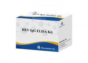 China HEV Human Igg Elisa Kit Diagnostic For IgG Antibody To Hepatitis E Virus wholesale