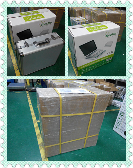PC based 3D Ultrasound Machine SS-9 Laptop Ultrasound scanner