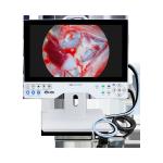 1080P Medical Grade 15.6 Inch Rigid All in One Endoscope Camera System With