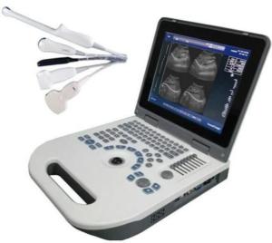 China OEM OB Obstetric Ultrasound Equipment LCD Display TGC Control wholesale