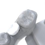 Pressed Ceramic Crowns Permament Dental Resin for All Sizes of Dental Businesses