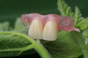 China Flexible Invisible Denture wholesale