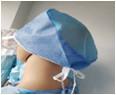 China Blue/Green Color Disposable Medical Cap-PP +SMS NON WOVEN wholesale