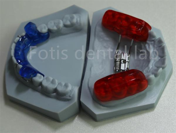 Effective Tooth Retention Dental Lab Orthodontic Space Keeper for Expanding