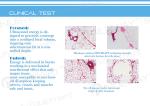 CE Approved Best High Quality High Intensity Focused Ultrasound HIFU Technology