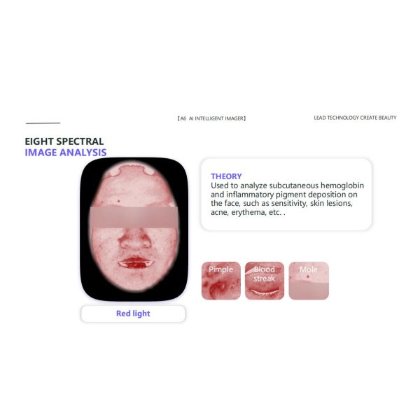 GMS- A6 Al Intelligent Face Analyzer Machine 8 Spectral Imaging Technologies for One Click Analysis of 15 Skin Problems