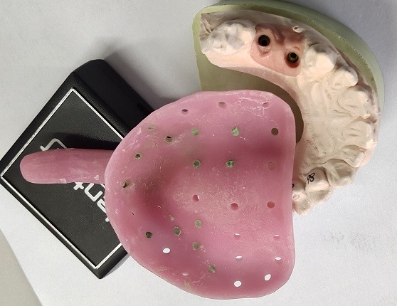 Custom Denture Impression Trays