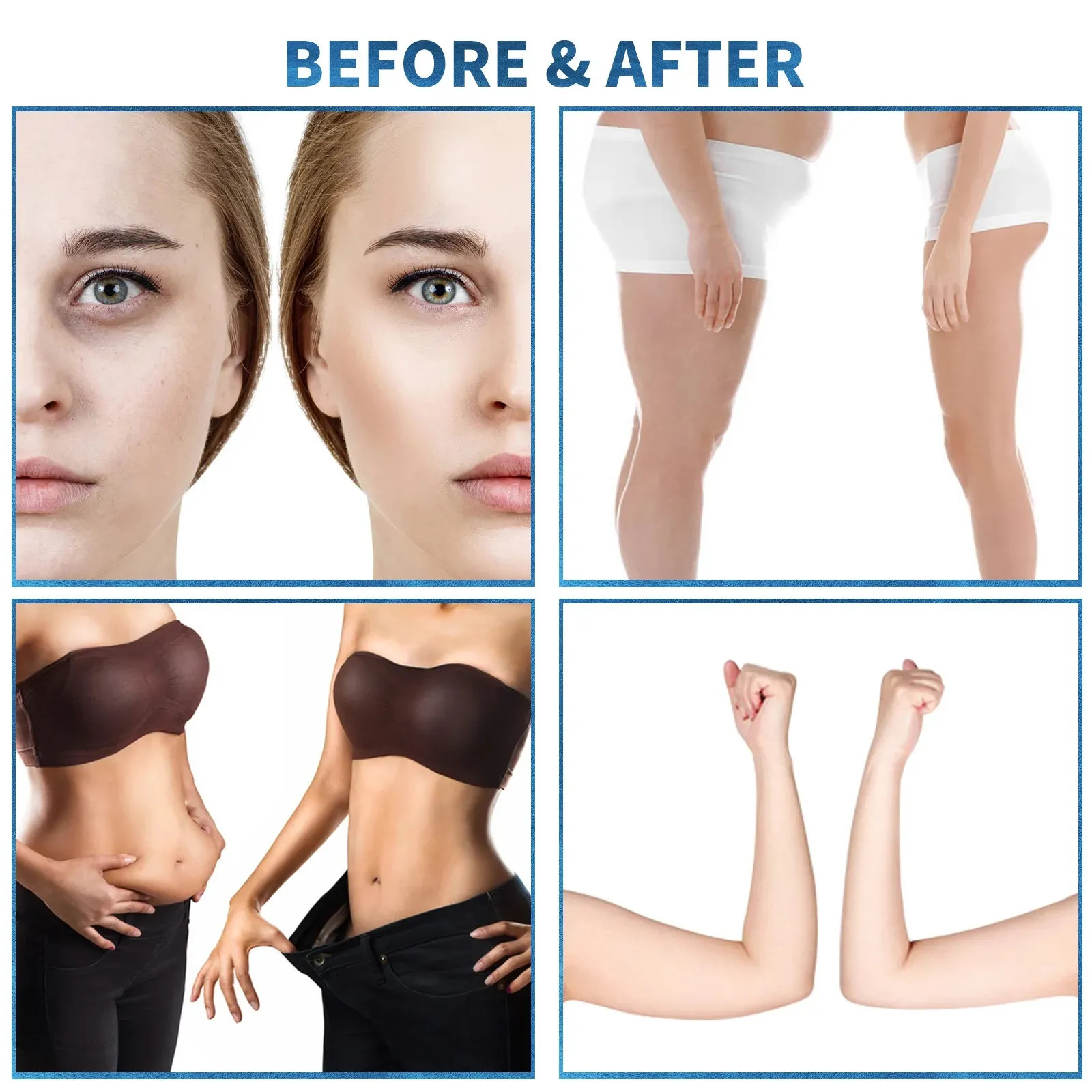 360 Degree Lymphatic Drainage Machine 9D RF Roller Ultrasound Body Sculpting Device