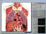 Mra Full Body 3d Nls Health Analyzer , Magnetic Resonance Imaging