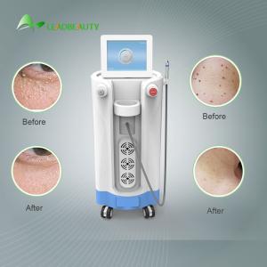 China For Blood Spider clearance Diode Laser Spider Vein Removal Machine 980nm wholesale