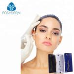 2.0ml Fine Medical Sodium Hyaluronate Gel Dermal Fillers Face Injection