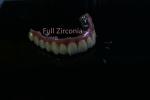 Health Safety CAD CAM Dental Implant Bar High Tech Biological Material