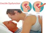 Erectile Dysfunction Physiotherapy Shockwave Therapy Machine