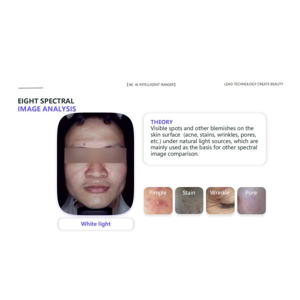 GMS- A6 Al Intelligent Face Analyzer Machine 8 Spectral Imaging Technologies for One Click Analysis of 15 Skin Problems