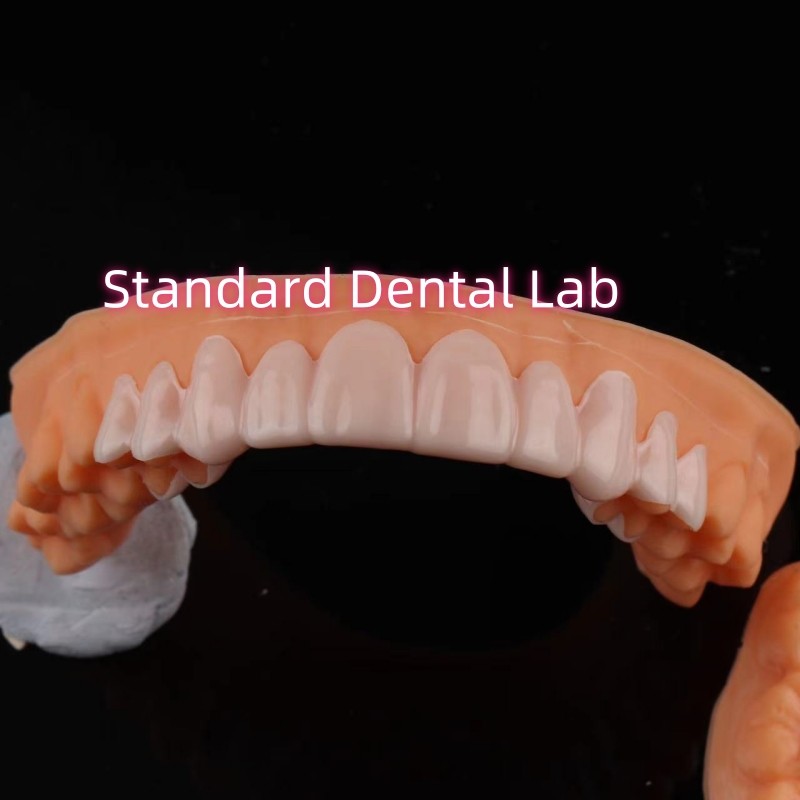 Dental Snap On Smile Veneers For Teeth Discolorations / Gaps