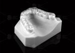 3D Printed Soft Occlusal Splints For Bruxism Comfort Dental Occlusal Splint