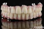 Natural Look Dental Laboratory Acrylic Teeth Finish For High Wear Resistance