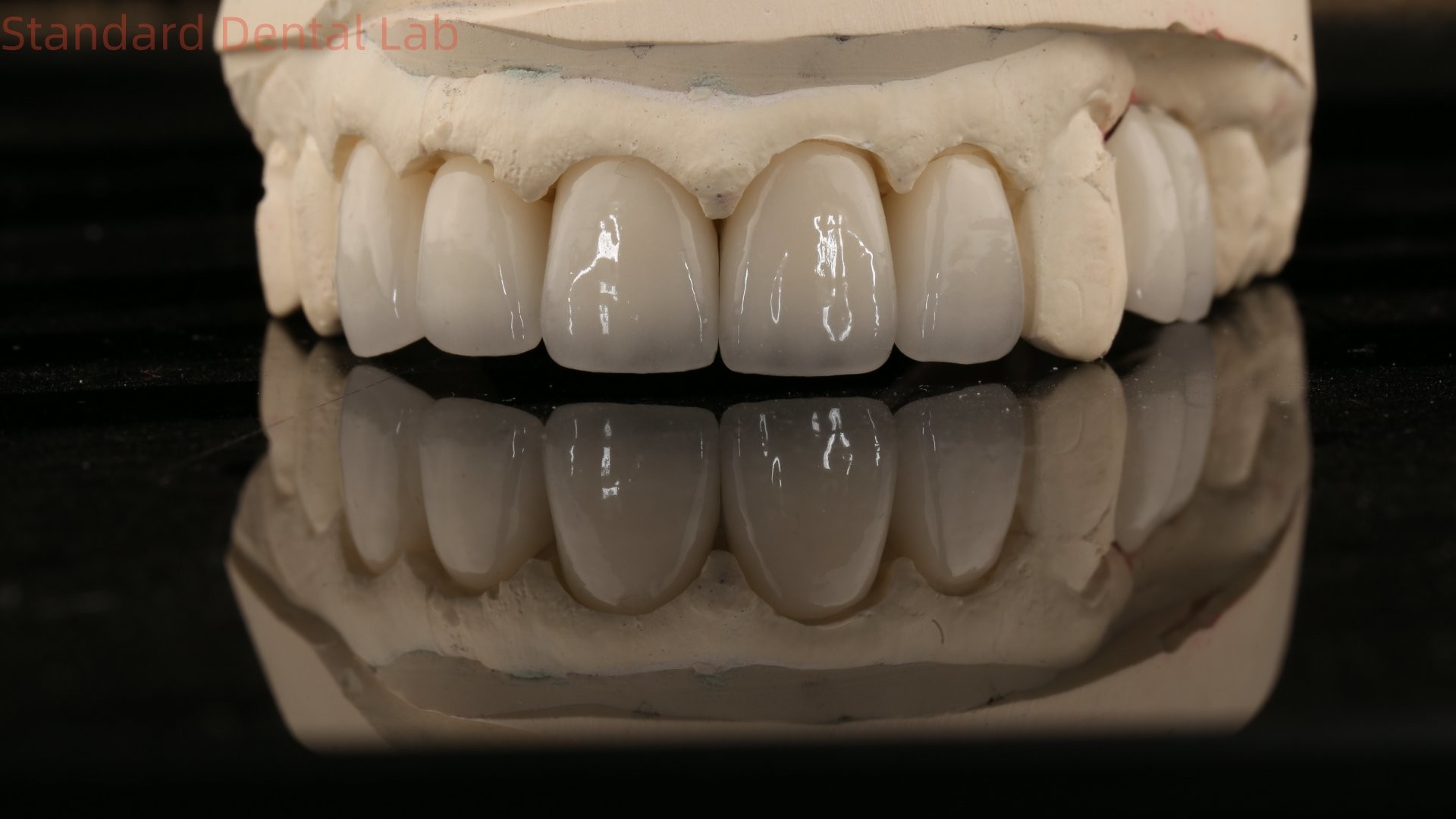 China Dental Lab Zirconia Full Contour Crown High Aesthetic Natural Dental Bridge 5 Year Guarantee