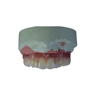 China Health Safety CAD CAM Dental Implant Bar High Tech Biological Material wholesale