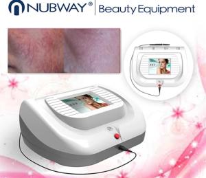 China 2018 Hot SALE Spider Vein Removal skin tags removal Machine Nubway Vascular vein removal wholesale