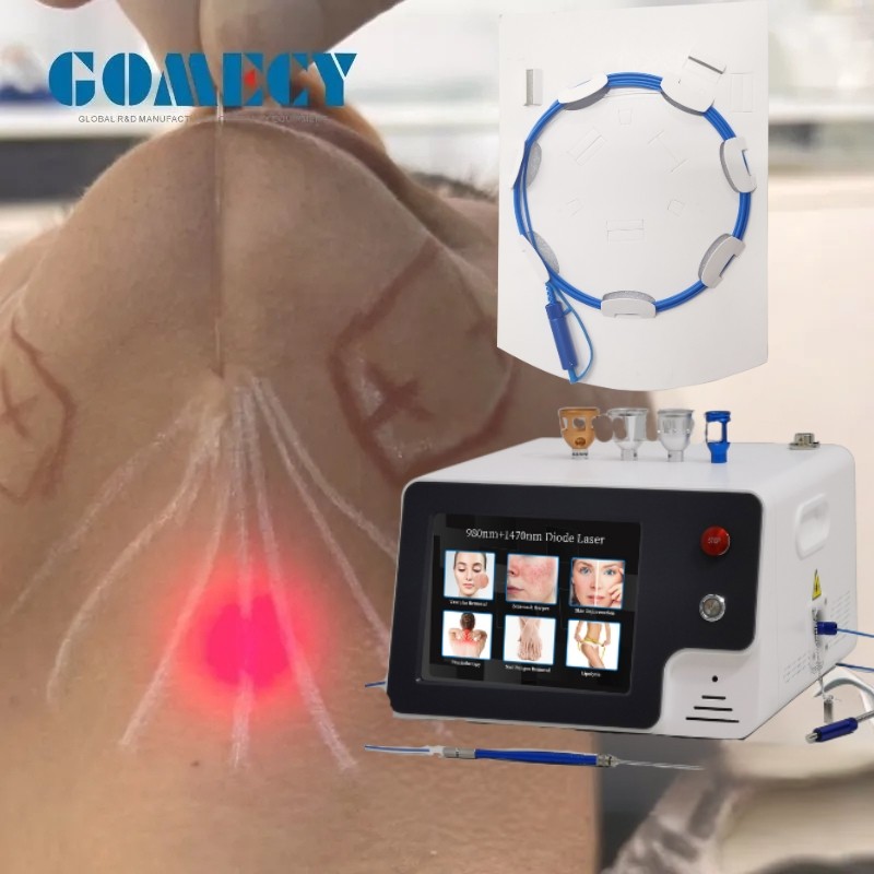 GOMECY 2025 980nm 1470nm Diode Laser for Endo Face Lift Endolaser Facial Contouring Fat Reduction and Tightening Pulse duration 0-1s stepping 0.05s