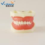 Professional Medical Dental Study Models VIC-L5 Peridontal Disease Model