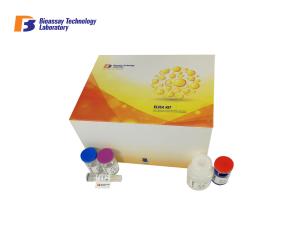 China High Precision Human Deoxypyridinoline Crosslinks DPD ELISA Kit 96 Wells wholesale