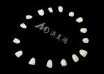 IPS EMAX Porcelain Veneers For Natural Looking Front Teeth Restorations