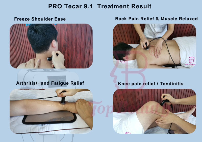 Touch Screen High Frequency Facial Machine For Commercial