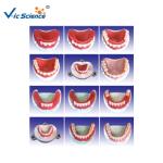 Producing Steps Of Marilan Bridge Dental Study Models For Teeth Teaching
