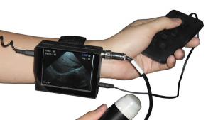 China Wrist Veterinary ultrasound scanner wrist veterinary ultrasound machine wholesale