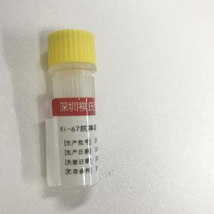China KISSH Primary Antibody Products Ki-67 Immunoassay Antibody Test IHC 1.5mL 3.0mL wholesale
