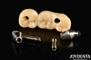 China Strong Implant Crown And Bridge Perfect Solution For Aesthetically Pleasing Esthetics wholesale