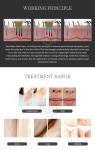 808nm diode laser hair removal machine with tattoo removal picosecond laser