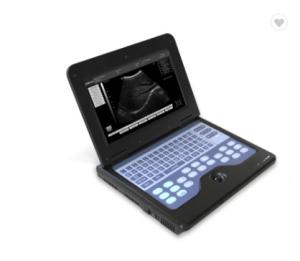 China CE 3.5MHz Doppler Ultrasound Equipment / Diagnostic Ultrasound Machine wholesale