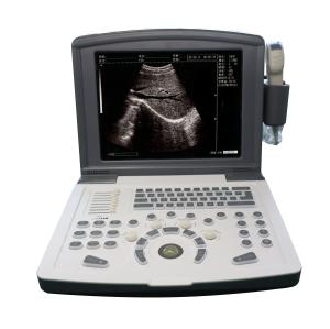 China Portable Full Digital Diagnostic Ultrasound scanner OEM wholesale