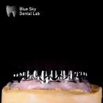 Pure Titanium Metal Frame Dental Malo Bridges For Silver And Gold Frame Color