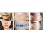 650-950nm / 560-950nm Laser Multifunction Beauty Machine For Skin Rejuvenation