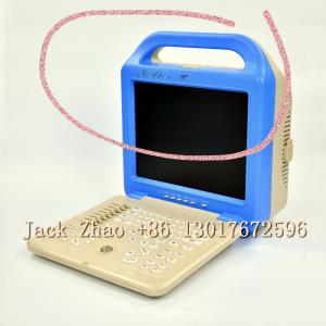 China Medbes Human Portable Ultrasound Machine Hospital Equipment Machine wholesale