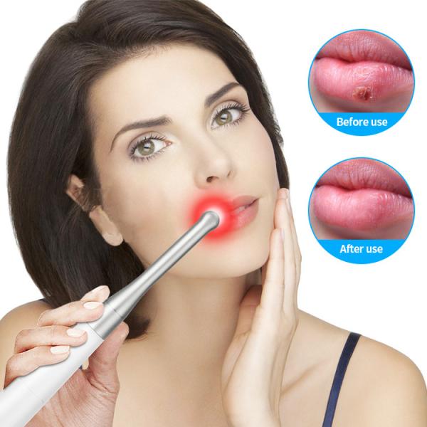 Handheld Infrared Physiotherapy Equipment 660nm 850nm Low EMF Light Oral