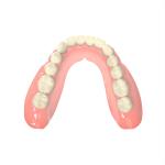 Natural Looking Denture Bases Biocompatible Resin Optimal Patient Comfort
