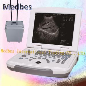 China 2D pORTABLE Ultrasound Scanner with High Quality wholesale