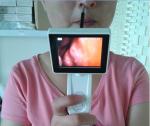 Retina Angiograph Digital 160° Ophthalmic Equipment