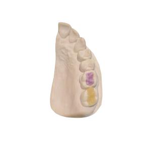 China Custom High-Density Custom Dental Ceramics FDA All-Ceramic Crown wholesale