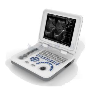 China OEM ODM Portable Ultrasound Machines For Home Use wholesale