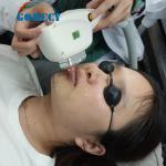 IPL SHR Elight Machine For Hair Removal And Skin Treatment