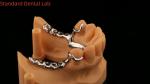 Metal Alloys Partial Cobalt Chrome Dentures Ivoclar Scheftner Comfortable China