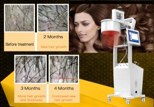 China 650nm Laser Hair Growth Machine Scalp Treatment Regrowth Salon Equipment on sale